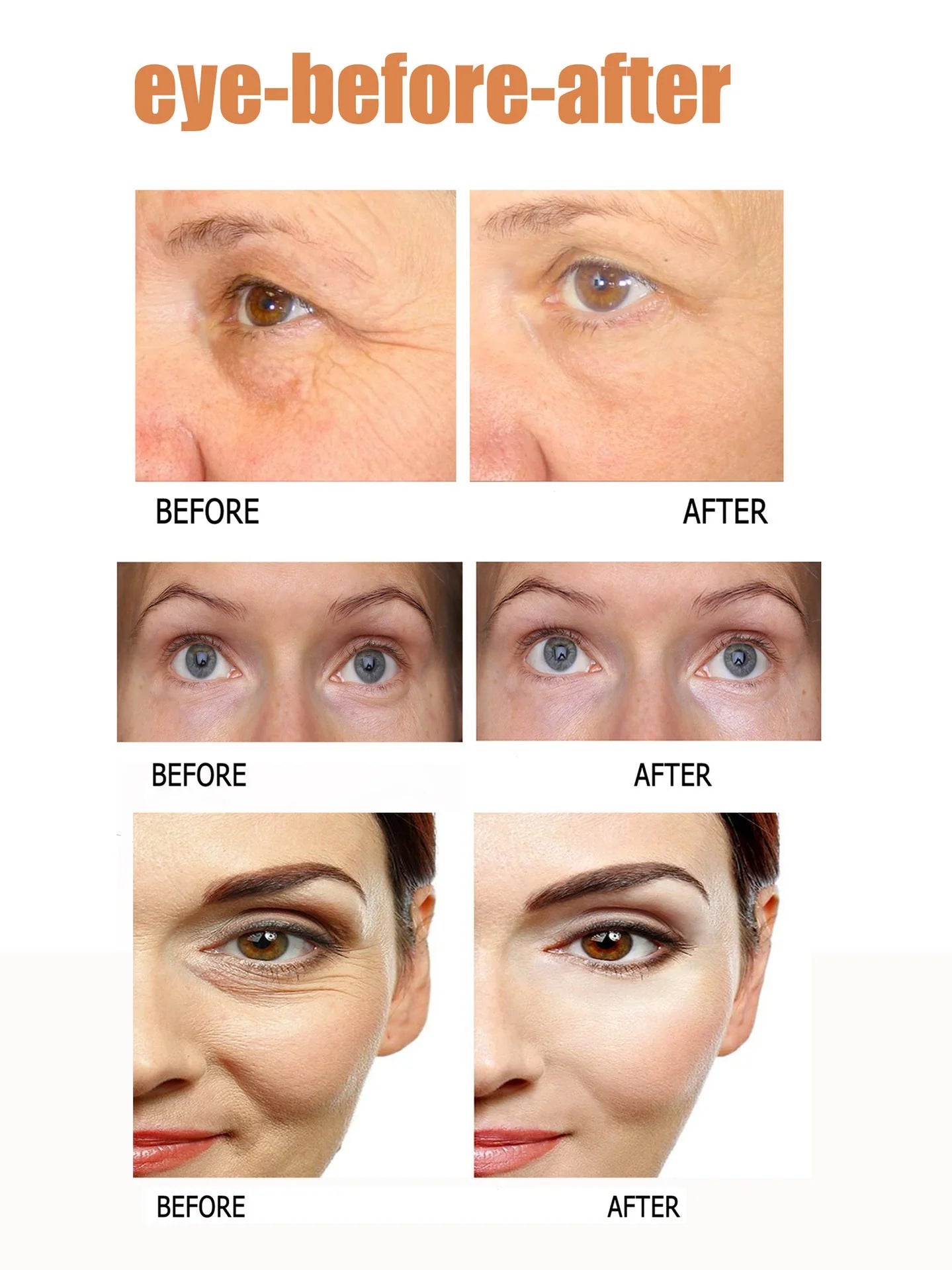 Eye Cream To Remove Eye Bags, Eye Cream , Eye Bag Care, Eye Care